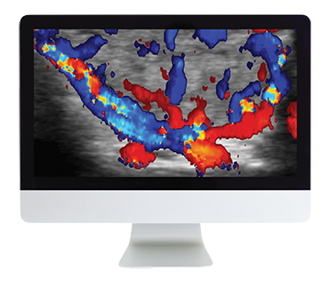 ARRS Thyroid Imaging 2019 ( VIDEOS) ARRS Thyroid Imaging 2019 ( VIDEOS)
