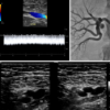 ASE Registered Physician in Vascular Interpretation ( RPVI ) Online Review Course 2023 ASE Registered Physician in Vascular Interpretation RPVI Online Review Course 2023