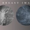 Advanced Breast Imaging 2024