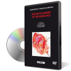 Aesthetic Surgery of the Aging Face (6 DVD BOX) Aesthetic Surgery of the Aging Face (6 DVD BOX)