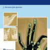 An Evidence Based Approach To The Fingertip Diseases