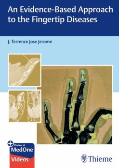 An Evidence Based Approach To The Fingertip Diseases