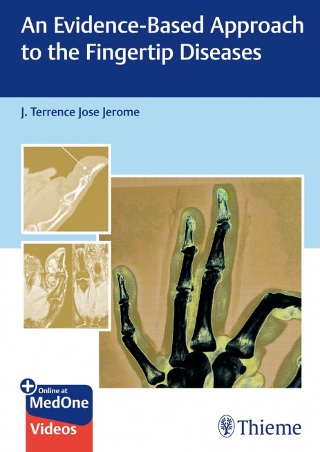 An Evidence-Based Approach To The Fingertip Diseases (Original PDF From Publisher) An Evidence Based Approach To The Fingertip Diseases