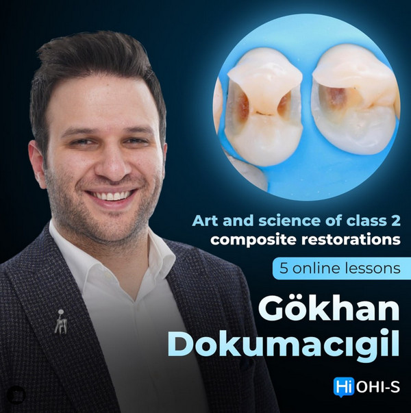 Art and Science of Class 2 Composite Restorations Art and Science of Class 2 Composite Restorations