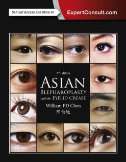 Asian Blepharoplasty and the Eyelid Crease 3rd Edition PDFVideos