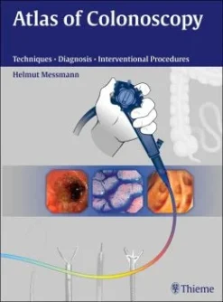Atlas Of Colonoscopy Examination Techniques And Diagnosis