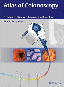 Atlas Of Colonoscopy: Examination Techniques And Diagnosis Atlas Of Colonoscopy Examination Techniques And Diagnosis