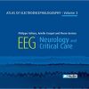 Atlas of Electroencephalography Volume 3: EEG Neurology and Critical Care (JOHN LIBBEY) 3rd Edition ( EPUB and pdf) Atlas of Electroencephalography Volume 3: EEG Neurology and Critical Care (JOHN LIBBEY) 3rd Edition ( EPUB )