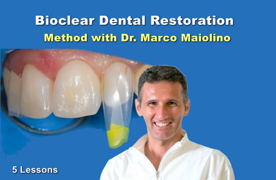 Bioclear Dental Restoration Bioclear Dental Restoration