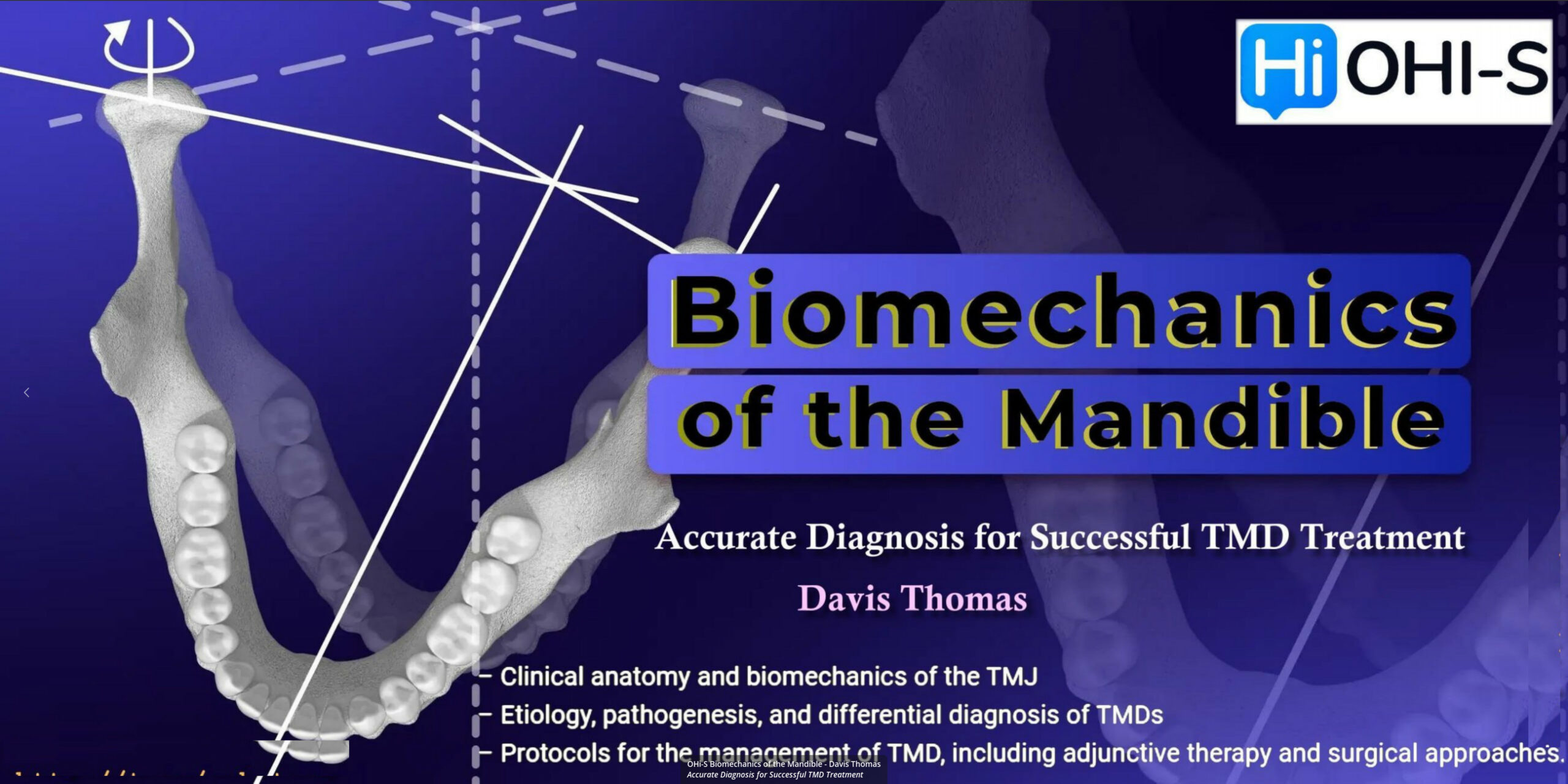 Biomechanics of the Mandible – Davis Thomas Accurate Diagnosis for Successful TMD Treatment Biomechanics of the Mandible – Davis Thomas Accurate Diagnosis for Successful TMD Treatment