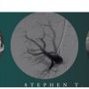CME Science Interventional Radiology Stephen T. Kee M.D 2021