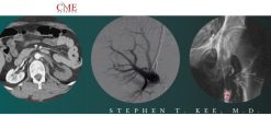CME Science Interventional Radiology Stephen T. Kee M.D 2021