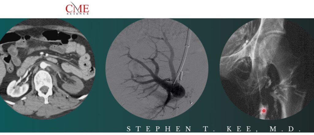 Science Interventional Radiology Stephen T. Kee, M.D 2021 (VIDEOS) CME Science Interventional Radiology Stephen T. Kee M.D 2021