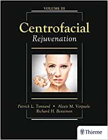Centrofacial Rejuvenation EPUB