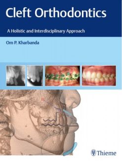 Cleft Orthodontics A Holistic And Interdisciplinary Approach Original PDF From Publisher
