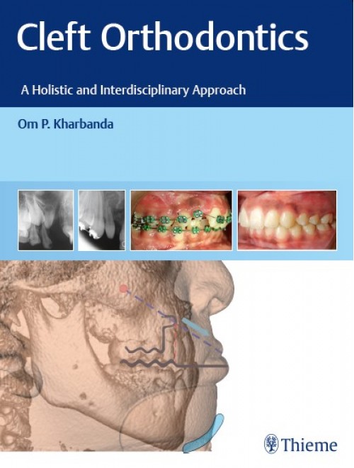 Cleft Orthodontics A Holistic And Interdisciplinary Approach (Original PDF From Publisher) Cleft Orthodontics A Holistic And Interdisciplinary Approach Original PDF From Publisher