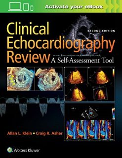 Clinical Echocardiography Review A Self Assessment Tool Second Edition pdf Only