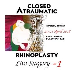 Closed Atraumatic Rhinoplasty Live Surgery DVD 1 Digital