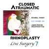 Closed Atraumatic Rhinoplasty Live Surgery DVD 7 2022 2 Cases.webp