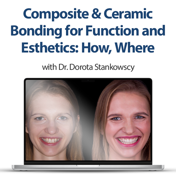 Composite & Ceramic Bonding for Function and Esthetics: How, Where & Why (2023) Composite & Ceramic Bonding for Function and Esthetics: How, Where & Why (2023)