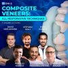 Composite Veneers, All Restorative Techniques Composite Veneers, All Restorative Techniques