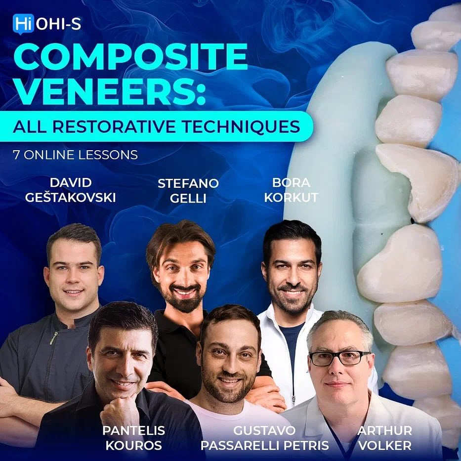 Composite Veneers, All Restorative Techniques Composite Veneers, All Restorative Techniques