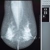Comprehensive Review of Breast Imaging 2022 Comprehensive Review of Breast Imaging 2022