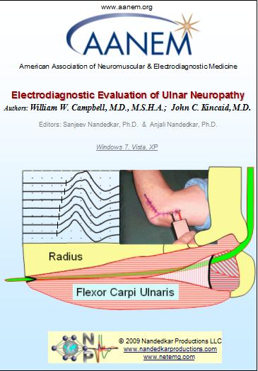 EMG/NCS Online Series: Volume VII Electrodiagnostic Evaluation of Ulnar Neuropathy EMG/NCS Online Series: Volume VII Electrodiagnostic Evaluation of Ulnar Neuropathy