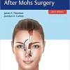 Facial Reconstruction After Mohs Surgery (videos and pdf ) Facial Reconstruction After Mohs Surgery (videos and pdf )