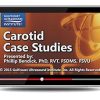 Gulfcoast Carotid Case Studies VideosPDFs