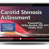 Gulfcoast Carotid Stenosis Assessment (Videos+PDFs) Gulfcoast Carotid Stenosis Assessment VideosPDFs