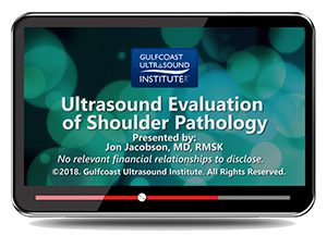 Gulfcoast: Ultrasound Evaluation of Shoulder Pathology Gulfcoast: Ultrasound Evaluation of Shoulder Pathology