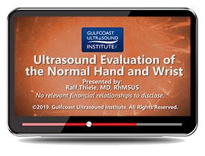 Gulfcoast: Ultrasound Evaluation of the Hand and Wrist Gulfcoast: Ultrasound Evaluation of the Hand and Wrist
