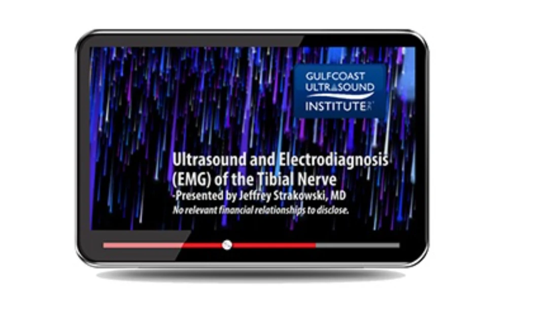 Gulfcoast Ultrasound and Electrodiagnosis (EMG) of the Tibial Nerve 2023 Gulfcoast Ultrasound and Electrodiagnosis EMG of the Tibial Nerve 2023