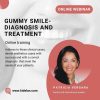 Gummy Smile – Diagnosis and Treatment Gummy Smile – Diagnosis and Treatment