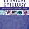 Handbook of Cervical Cytology: Special Emphasis on Liquid Based Cytology (Original PDF from Publisher) Handbook of Cervical Cytology: Special Emphasis on Liquid Based Cytology (Original PDF from Publisher)