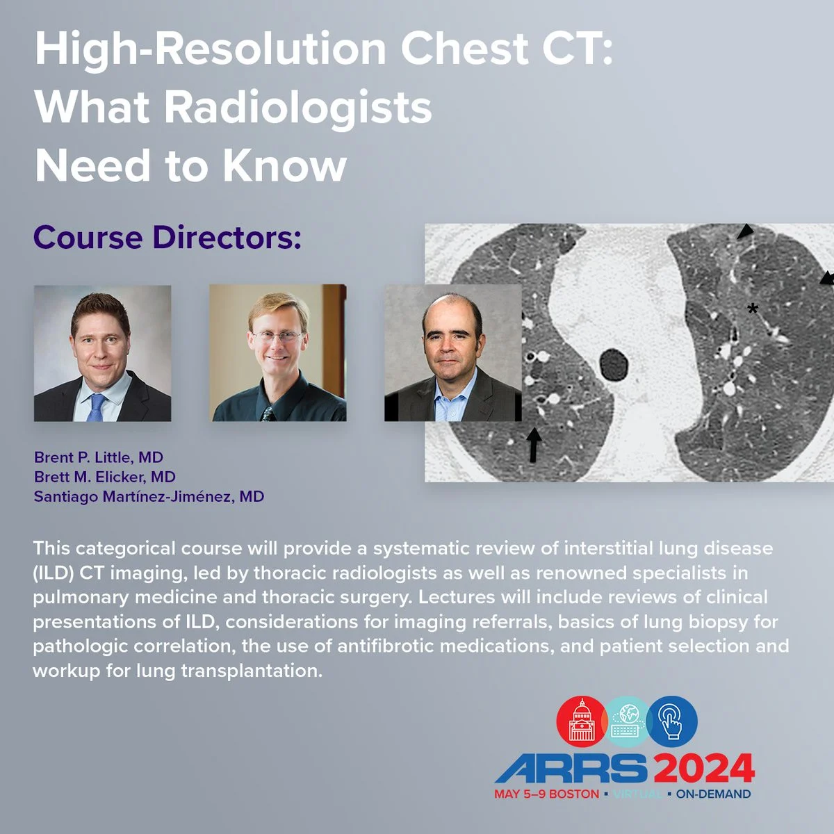 ARRS High-Resolution Chest CT 2024 ARRS High-Resolution Chest CT 2024