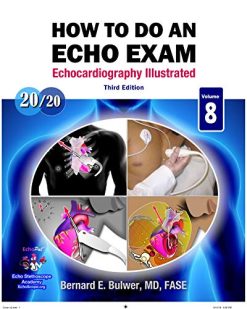 How to Do An Echo Exam Third Edition Echocardiography Illustrated Original PDF from Publisher