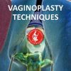 ISCG Vaginoplasty Techniques for Surgeons ISCG Vaginoplasty Techniques for Surgeons