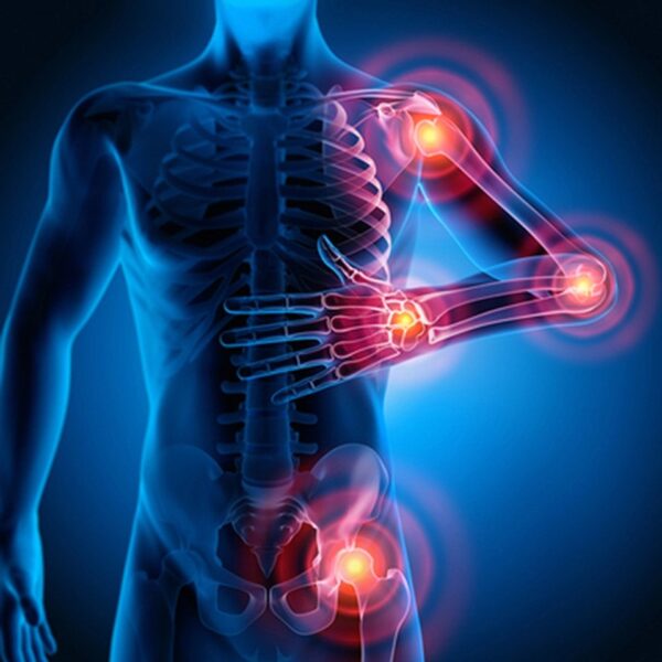 Intensive Update in Pain Management 2022 Intensive Update in Pain Management 2022