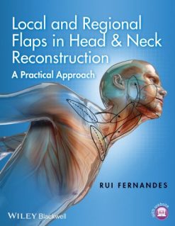 Local And Regional Flaps In Head And Neck Reconstruction A Practical Approach VideosPPT