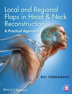 Local And Regional Flaps In Head Neck Reconstruction A Practical Approach Original PDF From Publisher