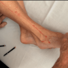 Lyftogt Perineural Injection Treatment videos: Mastering the Lower Leg Online Lyftogt Perineural Injection Treatment videos: Mastering the Lower Leg Online