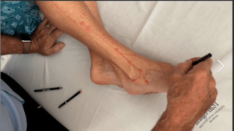 Lyftogt Perineural Injection Treatment videos: Mastering the Lower Leg Online Lyftogt Perineural Injection Treatment videos: Mastering the Lower Leg Online