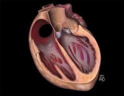 MRI Online Mastery Series Fundamentals of Cardiac MRI 2021