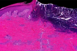 Mayo Clinic Wound Symposium