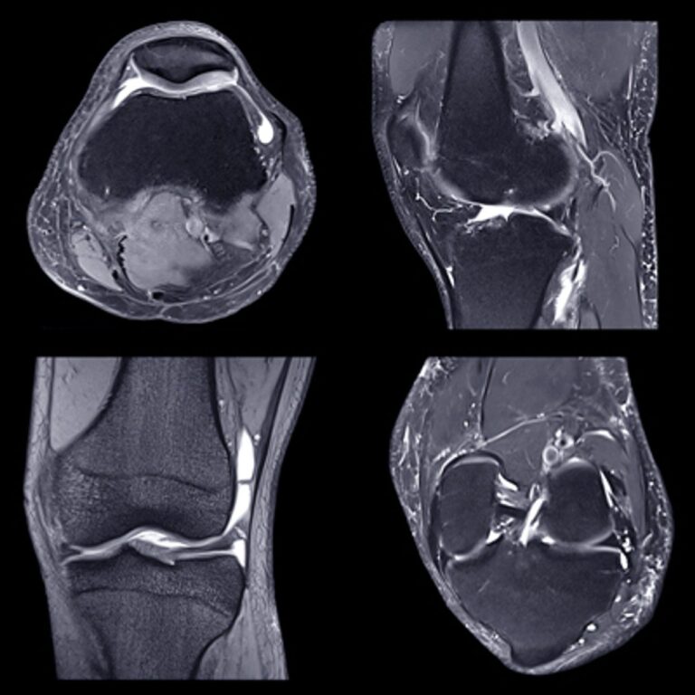 NYU Langone Advanced Imaging of the Musculoskeletal System Up Your Game 2023 NYU Langone Advanced Imaging of the Musculoskeletal System Up Your Game 2023