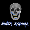 Ninja Zygoma – Implant Ninja Videos