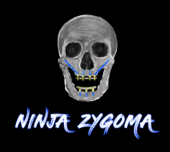 Ninja Zygoma – Implant Ninja Videos