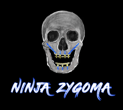 Ninja Zygoma – Implant Ninja Ninja Zygoma – Implant Ninja Videos